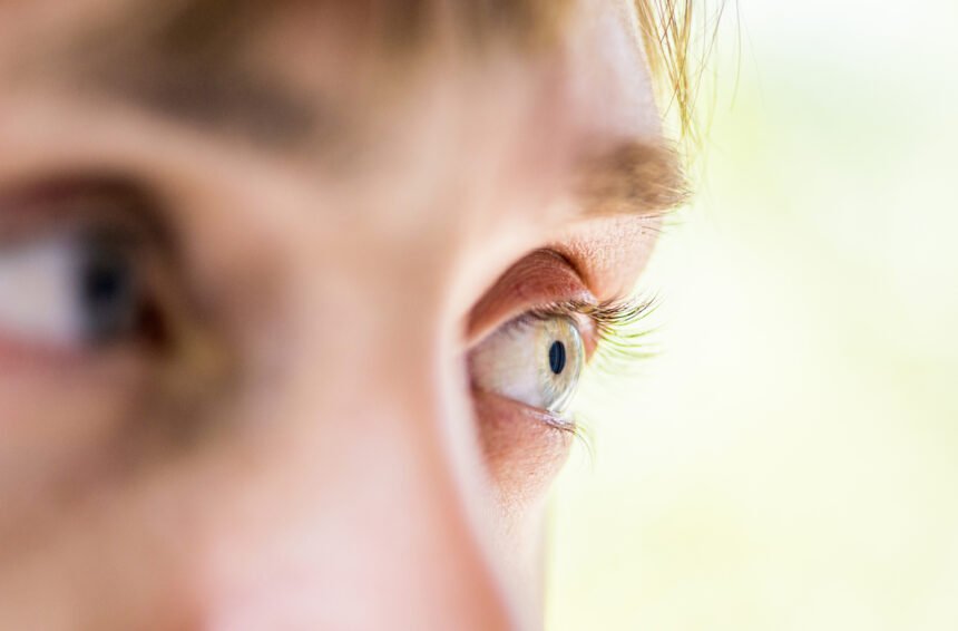 Existência de um tumor cerebral pode afetar qualquer parte do sistema nervoso central e por isso está associado aos olhos – iStock/Getty Images