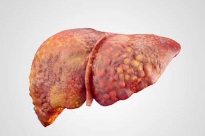O que fazer para limpar a gordura do fígado?